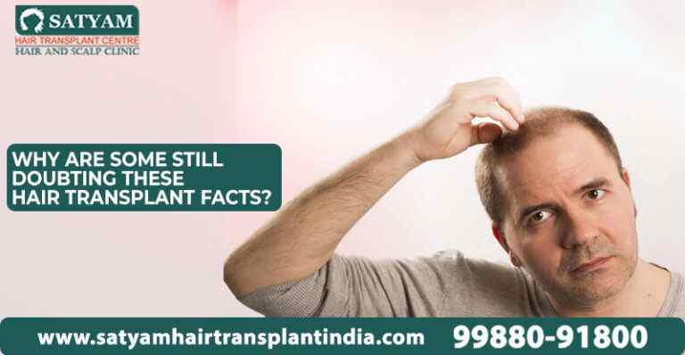 Why Do You Think You Have Hair Loss? This is Why!