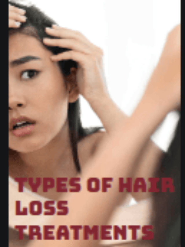 Types of hair loss treatments