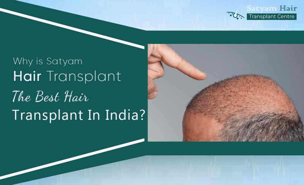 Why is Satyam Hair Transplant The Best Hair Transplant In India?