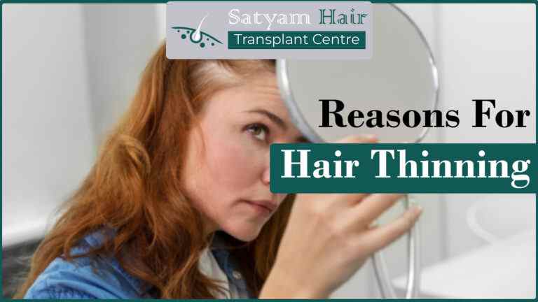 Reasons For Hair Thinning