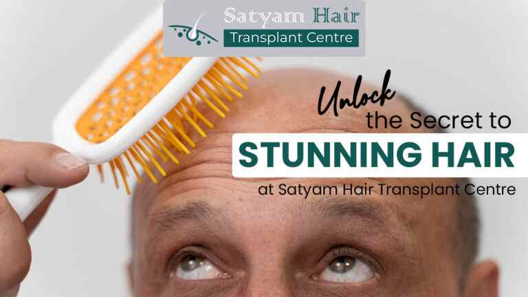 Unlock the Secret to Stunning Hair at Satyam Hair Transplant Centre