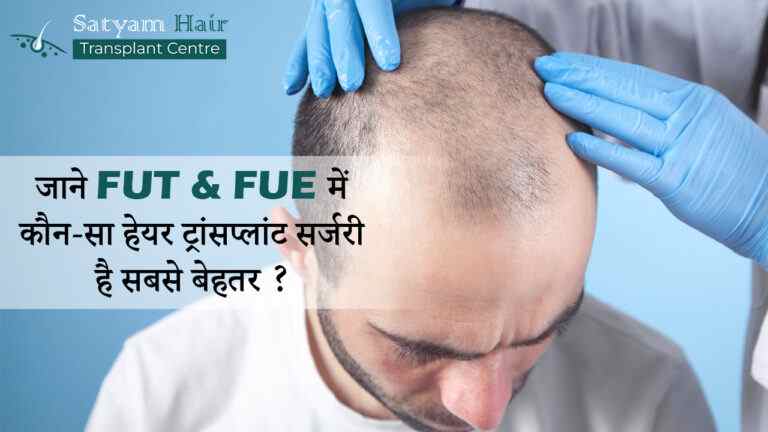 जाने FUT & FUE में कौन-सा हेयर ट्रांसप्लांट सर्जरी है सबसे बेहतर ?