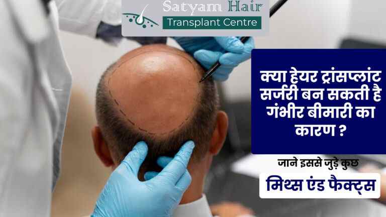 क्या हेयर ट्रांसप्लांट सर्जरी बन सकती है गंभीर बीमारी का कारण ? जाने इससे जुड़े कुछ मिथ्स एंड फैक्ट्स